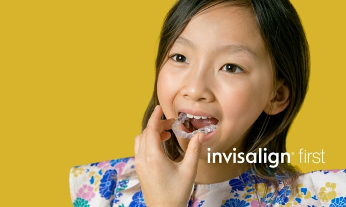 Invisalign First! Is it worth it?